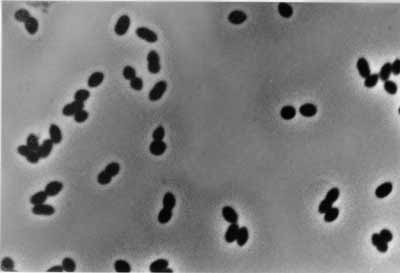 Bakteri Nitrosomonas sp